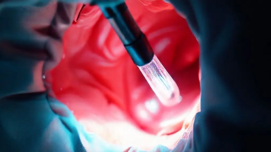 Enhancing Network Connectivity: Ultra-Flexible Fibers in Medical Endoscopy